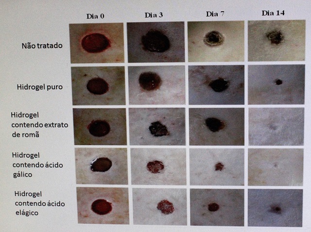 Resultado da aplicação do gel fotopolimerizável em até 14 dias de uso contínuo